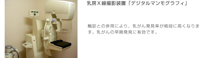 デジタルマンモグラフィ